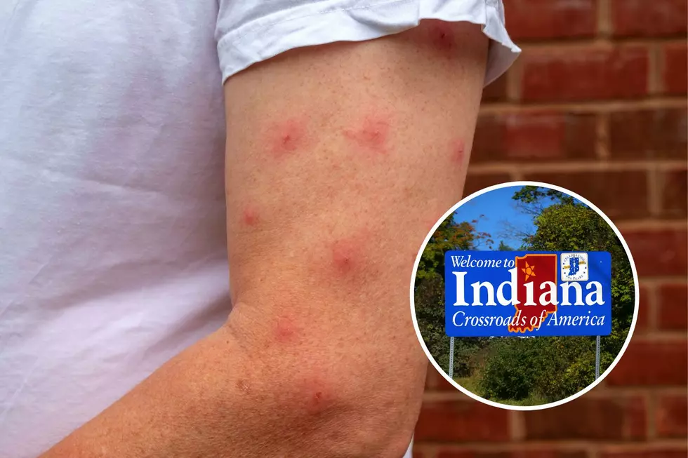 Amazing Bug Bite Healing Hack Found in Your Indiana Yard